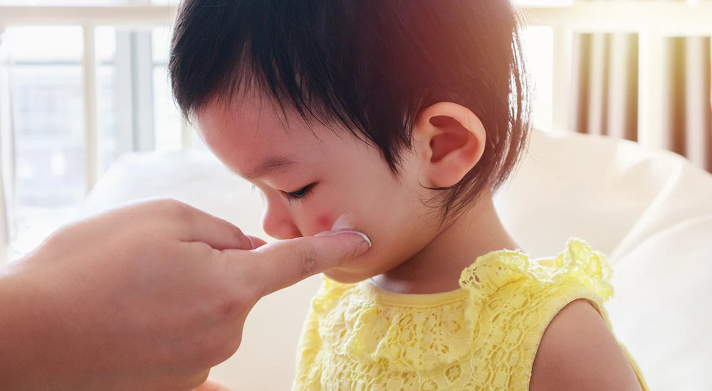 Baby Heat Rash and How to Care for Sensitive Skin